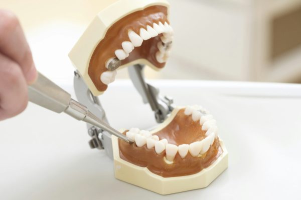 Tooth Extraction at a Japanese Dentist's Office