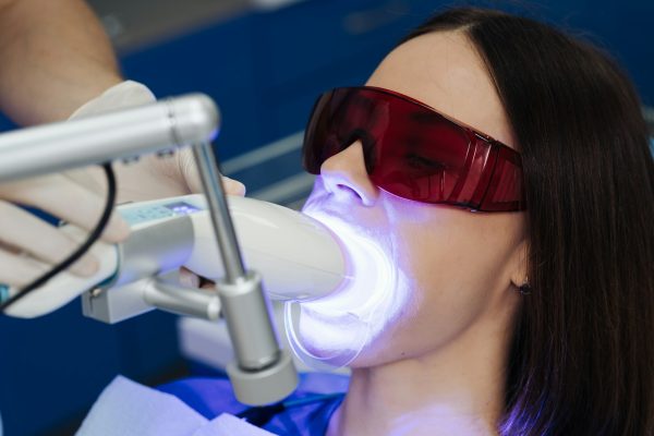 Whitening teeth procedure during visit at dentist.